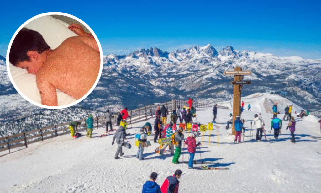 masern skigebiet österreich